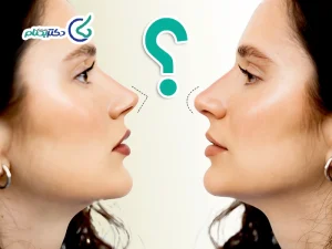 نوک تیز و گرد بینی