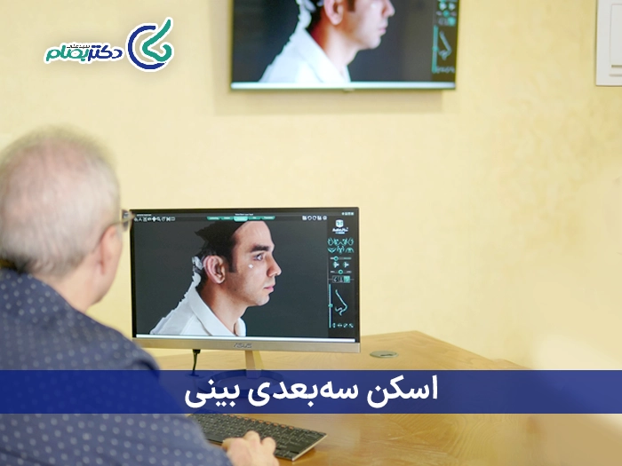 اسکن سه بعدی بینی