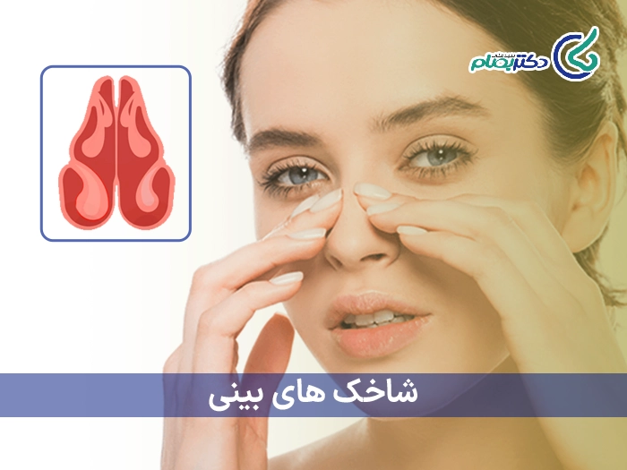 شاخک های بینی
