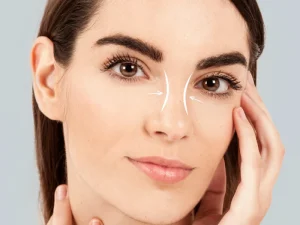 جراحی بینی غضروفی