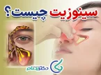 داروی سینوزیت