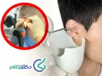 نحوه شستشوی گوش