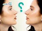 نوک تیز و گرد بینی